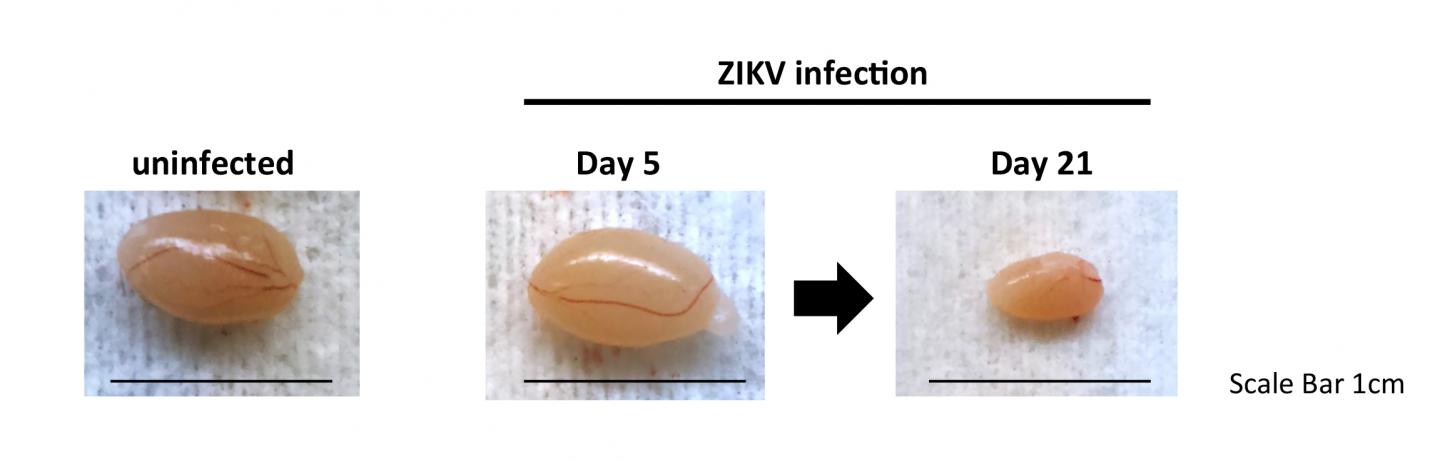 Zika Persists in Multiple Cell Types, Lowering Testosterone and Causing Testicular Atrophy (1 of 3)