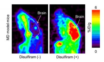 Brain PET Image at 4 Hours after 64CuCl2 Injection