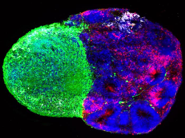 Bhaduri_cell_image_brain_assembloid_thalamus_cortex