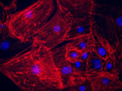Mature Cardiomyocyte