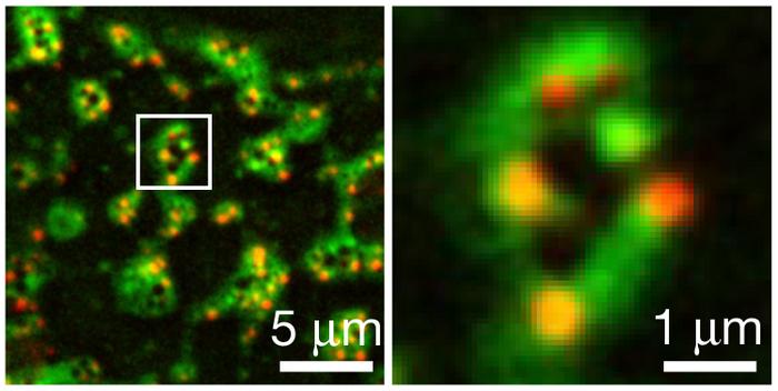 Cell death's 'beautiful' rings: Microscopy images
