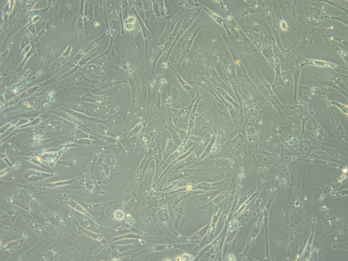 Brain cancer patients