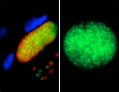 <I>Toxoplasma</I> Parasites