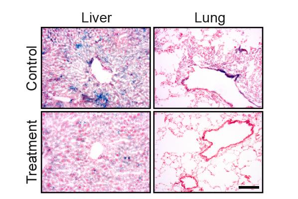 Senescent Cells Removal