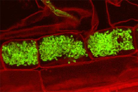 Fungal Arbuscules Inside Root Cells
