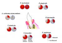 口腔内細菌は食道がんのリスクファクターである | EurekAlert!