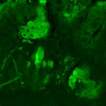 Video of Lipid Formation in Sweat Glands of Mouse
