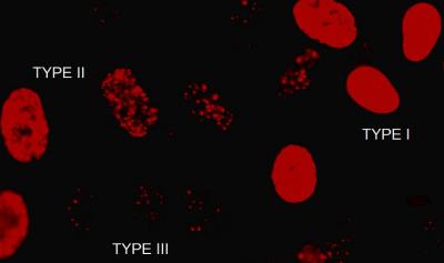 Damage in Human Fibroblasts Will Be Measured