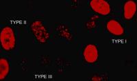 Damage in Human Fibroblasts Will Be Measured