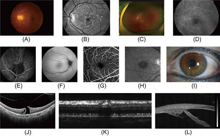 Overview of ophthalmic imaging modalities.