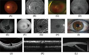 Overview of ophthalmic imaging modalities.