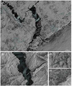 Nematodes invading European beech leaf tissue under electron microscope