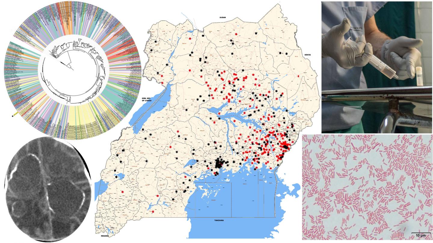 Pan-Microbial Study Implicates a Potential Culprit in a Pediatric Brain Disorder in Uganda (3 of 9)