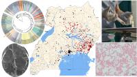 Pan-Microbial Study Implicates a Potential Culprit in a Pediatric Brain Disorder in Uganda (3 of 9)