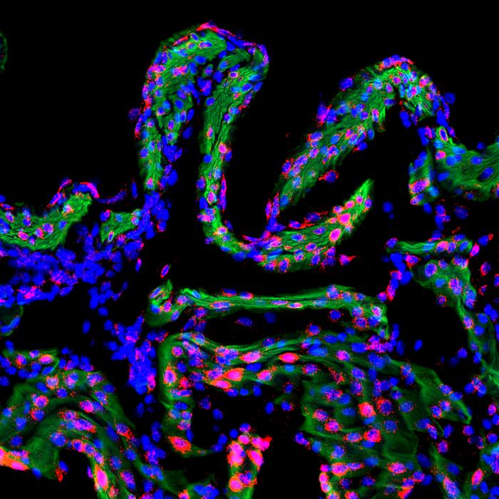 Scripps Research study reveals how uterine contractions are regulated by stretch and pressure during childbirth