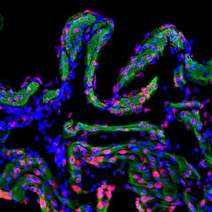 Scripps Research study reveals how uterine contractions are regulated by stretch and pressure during childbirth