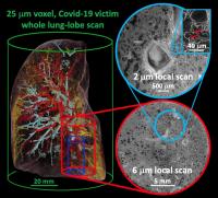 ESRF and UCL scientists awarded Chan Zuckerberg Initiative grant for human organ imaging project