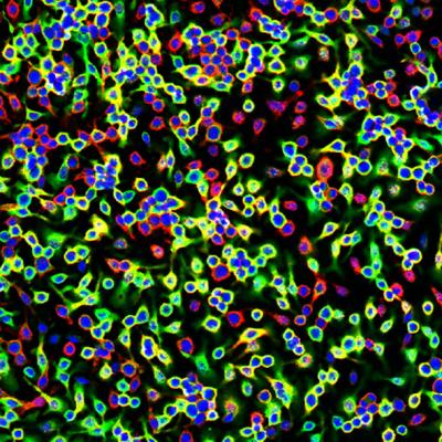 Macrophages