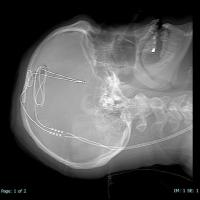 Implantation