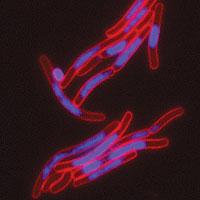 FIC Toxins