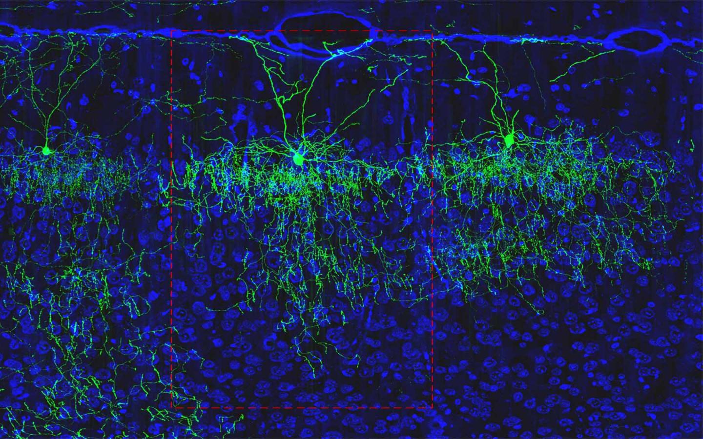 Axo-Axonic Cell