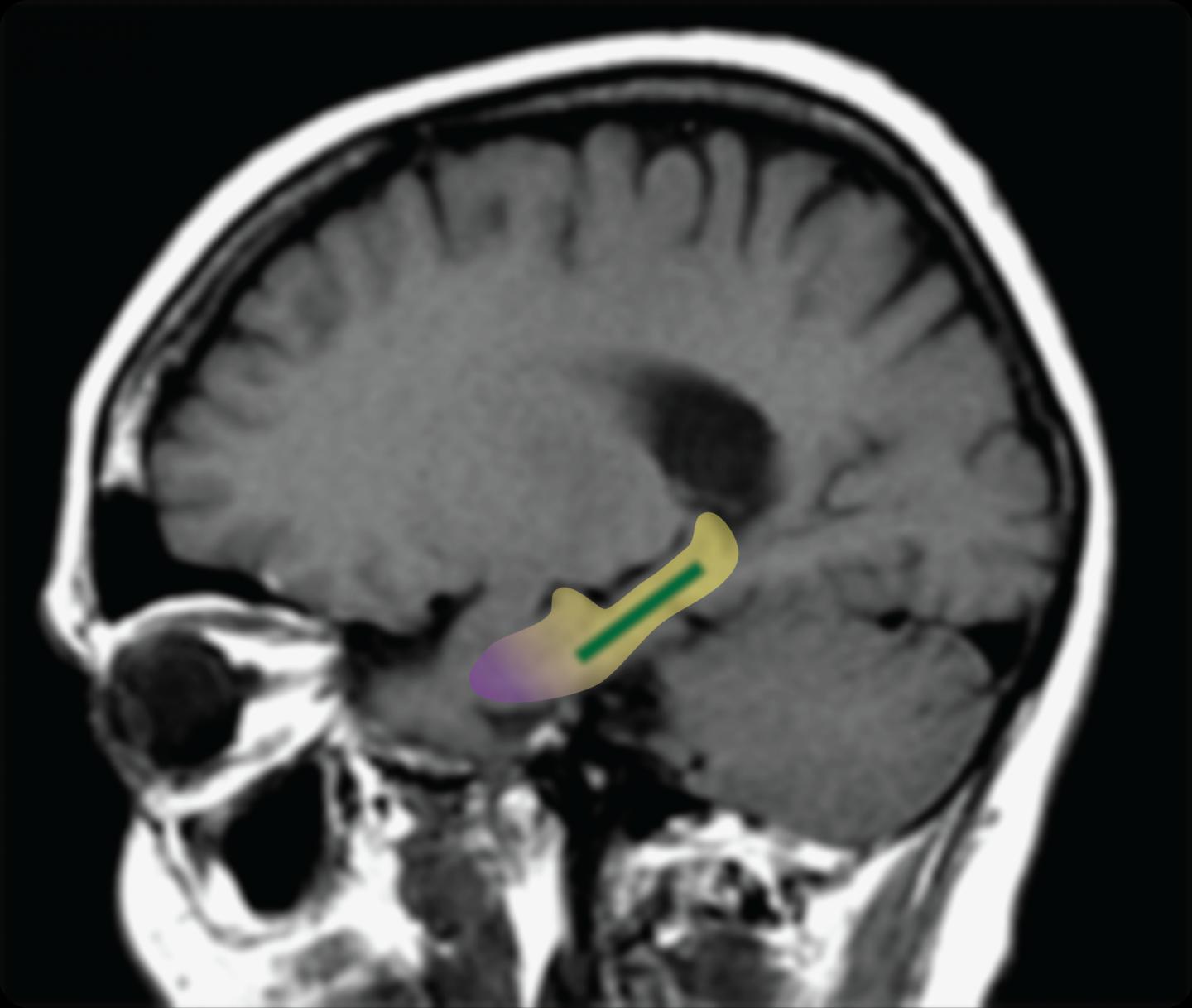 Areas of the Brain