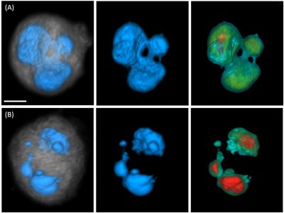Irregular MDA-MB-231 Nuclear Morphologies