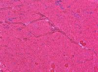 Gene Therapy Treated Muscle