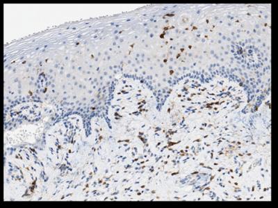 Tissue Stained for Cells Containing CD4 Receptors