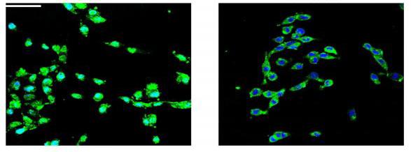 Pinpointing the Formation of Cancer Stem Cells (1 of 1)