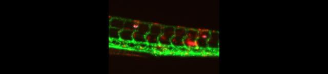 <i>Mycobacterium marinum</i> Infection in Zebrafish (2 of 2)