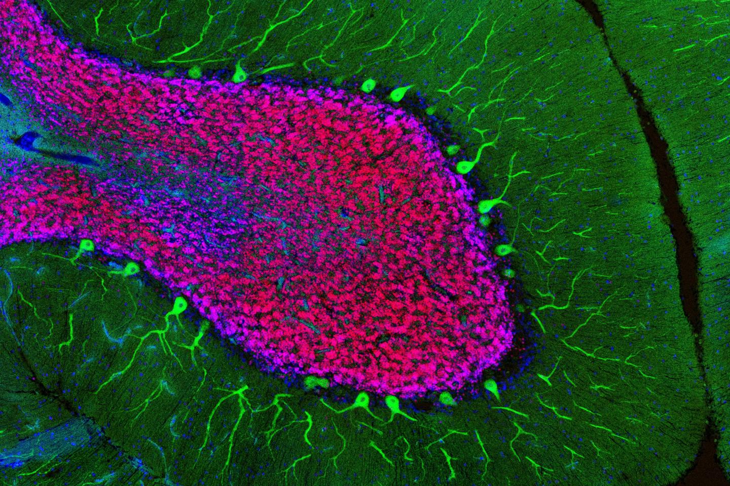 Cerebellum