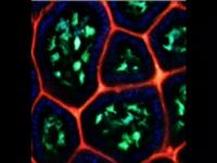 Dendritic Cells in the Intestine