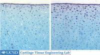 Flexed and Immobile Joint Cartilage