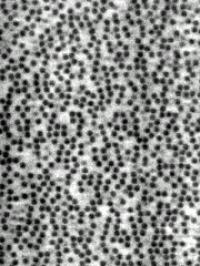 Microscopic Particles Form Strings