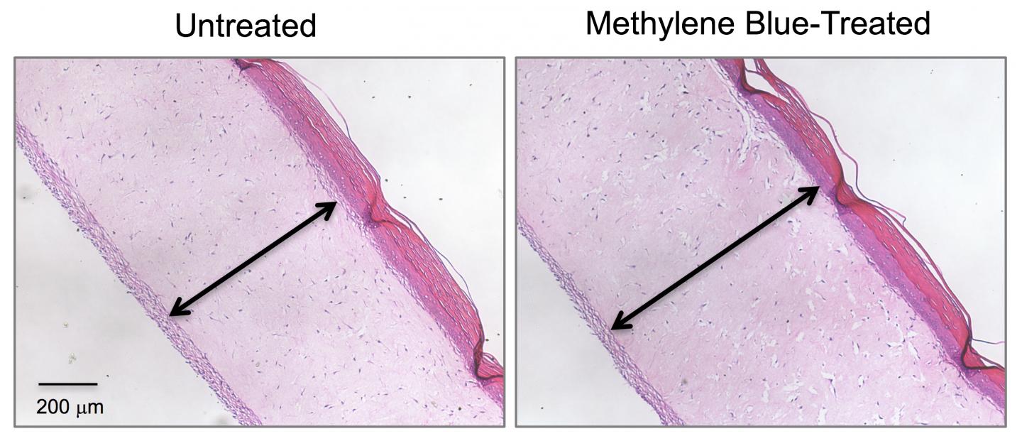 Methylene Blue Thickens Dermis Layer in Model Skin