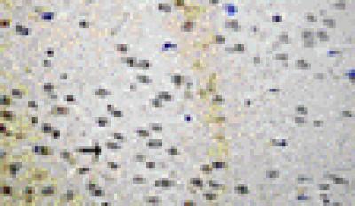 Synaptosomal-Associated Protein-25 Positive Cells