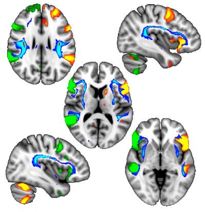 Brain Scans