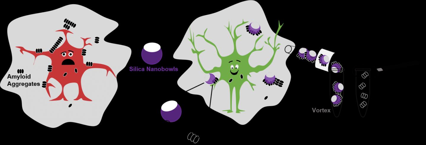 Amyloid Beta Plaques