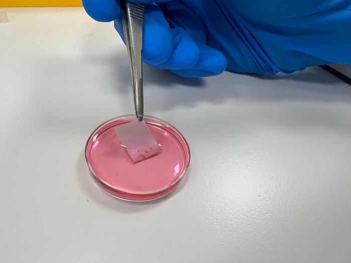 Bioengineered artificial skin for burn treatment - stable, easy to handle, and fully autologous.