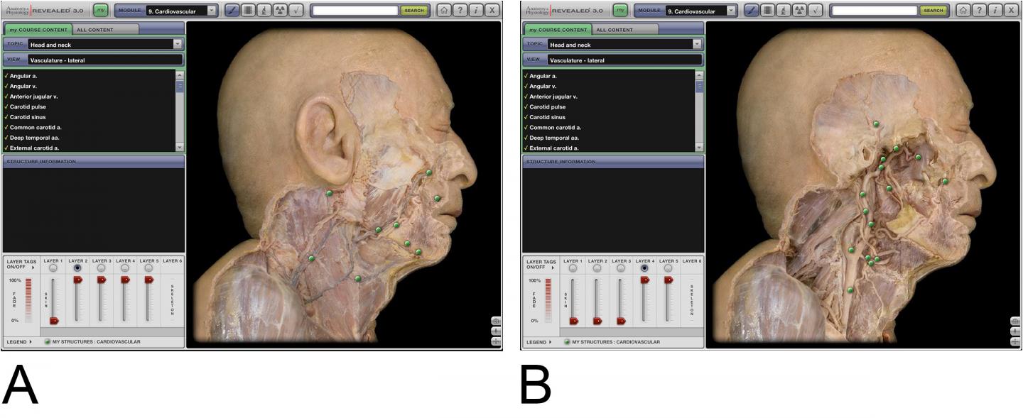 Computer Simulation