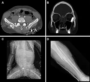 Representative injuries in patients from the mass casualty incident of October 7, 2023.