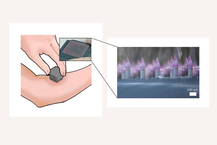 A 3D-printed delivery system enhances vaccine delivery via microneedle array patch