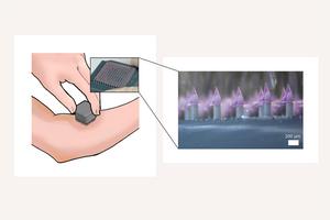 A 3D-printed delivery system enhances vaccine delivery via microneedle array patch