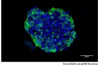 Cancer Organoid