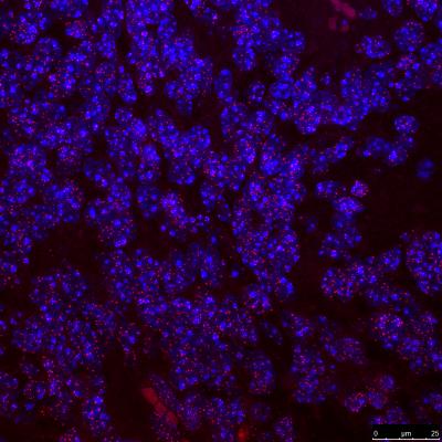 TRF1 Expression