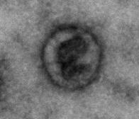 Human Cardiosphere-derived Exosome