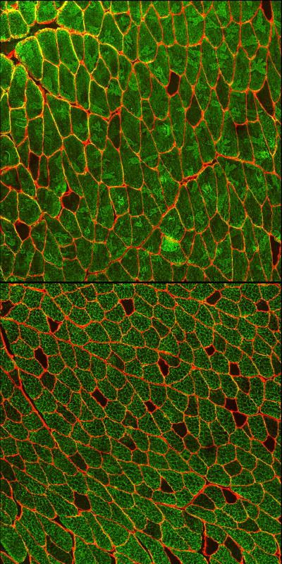 Muscle Fiber