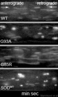 Axonal Organelle Transport in Motion