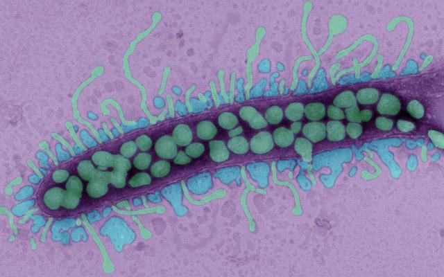 Bacteriaphages Attacking Bacterium, Thomas Deerinck, UC San Diego NCMIR